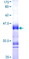 SELE / CD62E / E-selectin Protein - 12.5% SDS-PAGE Stained with Coomassie Blue.