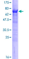 Selenium Binding Protein 1 Protein - 12.5% SDS-PAGE of human SELENBP1 stained with Coomassie Blue