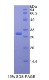Selenium Binding Protein 1 Protein - Recombinant Selenium Binding Protein 1 By SDS-PAGE