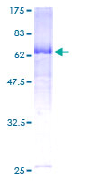SELL / L-Selectin / CD62L Protein - 12.5% SDS-PAGE of human SELL stained with Coomassie Blue