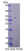 SELN / SEPN1 Protein - Recombinant Selenoprotein N1 (SEPN1) by SDS-PAGE