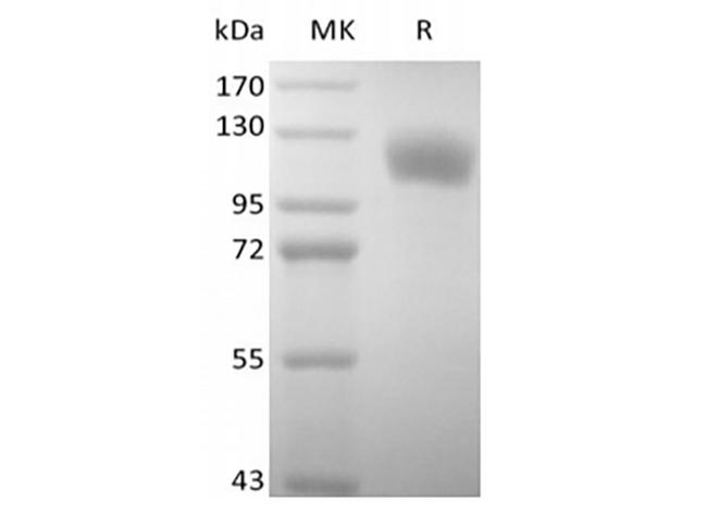 SELP / P-Selectin / CD62P Protein - Recombinant Human P-selectin/CD62P (C-6His)
