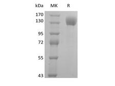 SELP / P-Selectin / CD62P Protein - Recombinant Human P-selectin/CD62P (C-Fc)