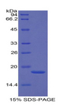 SELP / P-Selectin / CD62P Protein - Recombinant Selectin, Platelet By SDS-PAGE