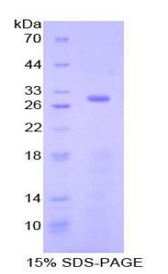 SELP / P-Selectin / CD62P Protein - Recombinant Selectin, Platelet By SDS-PAGE