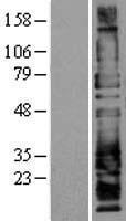 SELPLG / PSGL-1 / CD162 Protein - Western validation with an anti-DDK antibody * L: Control HEK293 lysate R: Over-expression lysate