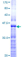 SEMA3A / Semaphorin 3A Protein - 12.5% SDS-PAGE Stained with Coomassie Blue.