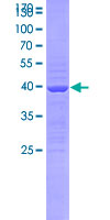 SEMA3B / SemA Protein - 12.5% SDS-PAGE Stained with Coomassie Blue