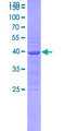 SEMA3B / SemA Protein - 12.5% SDS-PAGE Stained with Coomassie Blue