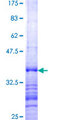 SEMA3B / SemA Protein - 12.5% SDS-PAGE Stained with Coomassie Blue.