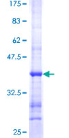 SEMA3C / Semaphorin 3C Protein - 12.5% SDS-PAGE Stained with Coomassie Blue.