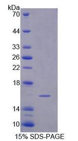 SEMA3C / Semaphorin 3C Protein - Recombinant Semaphorin 3C By SDS-PAGE