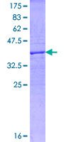 SEMA3D / Semaphorin 3D Protein - 12.5% SDS-PAGE Stained with Coomassie Blue.