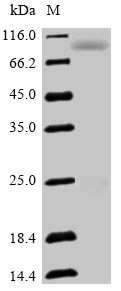 SEMA3F / Semaphorin 3F Protein - (Tris-Glycine gel) Discontinuous SDS-PAGE (reduced) with 5% enrichment gel and 15% separation gel.
