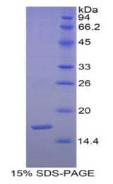 SEMA3F / Semaphorin 3F Protein - Recombinant Semaphorin 3F By SDS-PAGE
