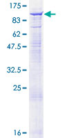 SEMA4A / Semaphorin 4A Protein - 12.5% SDS-PAGE of human SEMA4A stained with Coomassie Blue