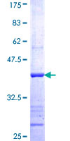 SEMA4A / Semaphorin 4A Protein - 12.5% SDS-PAGE Stained with Coomassie Blue.