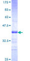 SEMA4B / Semaphorin 4B Protein - 12.5% SDS-PAGE Stained with Coomassie Blue.