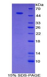 SEMA4B / Semaphorin 4B Protein - Recombinant Semaphorin 4B By SDS-PAGE