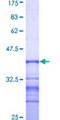 SEMA4D / Semaphorin 4D / CD100 Protein - 12.5% SDS-PAGE Stained with Coomassie Blue.