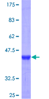SEMA4G / Semaphorin 4G Protein - 12.5% SDS-PAGE of human SEMA4G stained with Coomassie Blue