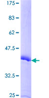 SEMA4G / Semaphorin 4G Protein - 12.5% SDS-PAGE of human SEMA4G stained with Coomassie Blue
