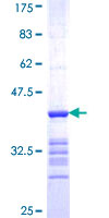 SEMA4G / Semaphorin 4G Protein - 12.5% SDS-PAGE Stained with Coomassie Blue.