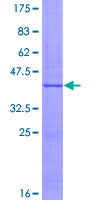 SEMA5A / Semaphorin 5A Protein - 12.5% SDS-PAGE Stained with Coomassie Blue.