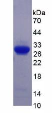 SEMA5B / Semaphorin 5B Protein - Recombinant Semaphorin 5B By SDS-PAGE