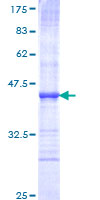 SEMA6A / Semaphorin 6A Protein - 12.5% SDS-PAGE Stained with Coomassie Blue.