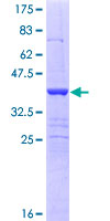 SEMA6B / Semaphorin 6B Protein - 12.5% SDS-PAGE Stained with Coomassie Blue.