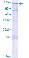 SEMA6C / Semaphorin 6C Protein - 12.5% SDS-PAGE of human SEMA6C stained with Coomassie Blue