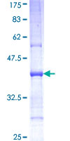 SEMA6C / Semaphorin 6C Protein - 12.5% SDS-PAGE Stained with Coomassie Blue.