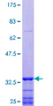 SEMA6D / Semaphorin 6D Protein - 12.5% SDS-PAGE Stained with Coomassie Blue.