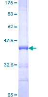 SEMA7A / Semaphorin 7A Protein - 12.5% SDS-PAGE Stained with Coomassie Blue.