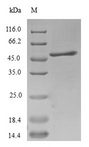 SEMG1 Protein - (Tris-Glycine gel) Discontinuous SDS-PAGE (reduced) with 5% enrichment gel and 15% separation gel.