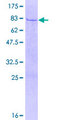 SEMG1 Protein - 12.5% SDS-PAGE of human SEMG1 stained with Coomassie Blue