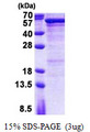 SEMG1 Protein