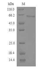 SEMG2 Protein - (Tris-Glycine gel) Discontinuous SDS-PAGE (reduced) with 5% enrichment gel and 15% separation gel.