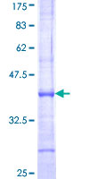 SENP1 Protein - 12.5% SDS-PAGE Stained with Coomassie Blue.