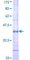 SENP1 Protein - 12.5% SDS-PAGE Stained with Coomassie Blue.