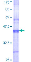 SENP3 Protein - 12.5% SDS-PAGE Stained with Coomassie Blue.