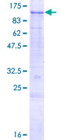 SENP5 Protein - 12.5% SDS-PAGE of human SENP5 stained with Coomassie Blue