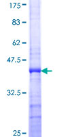 SENP5 Protein - 12.5% SDS-PAGE Stained with Coomassie Blue.