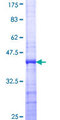 SENP5 Protein - 12.5% SDS-PAGE Stained with Coomassie Blue.