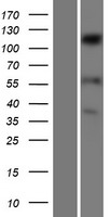 SENP6 Protein - Western validation with an anti-DDK antibody * L: Control HEK293 lysate R: Over-expression lysate