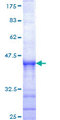 SENP6 Protein - 12.5% SDS-PAGE Stained with Coomassie Blue.