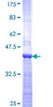 SENP7 Protein - 12.5% SDS-PAGE Stained with Coomassie Blue.