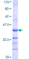SENP8 Protein - 12.5% SDS-PAGE Stained with Coomassie Blue.