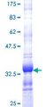 SEP15 Protein - 12.5% SDS-PAGE Stained with Coomassie Blue.